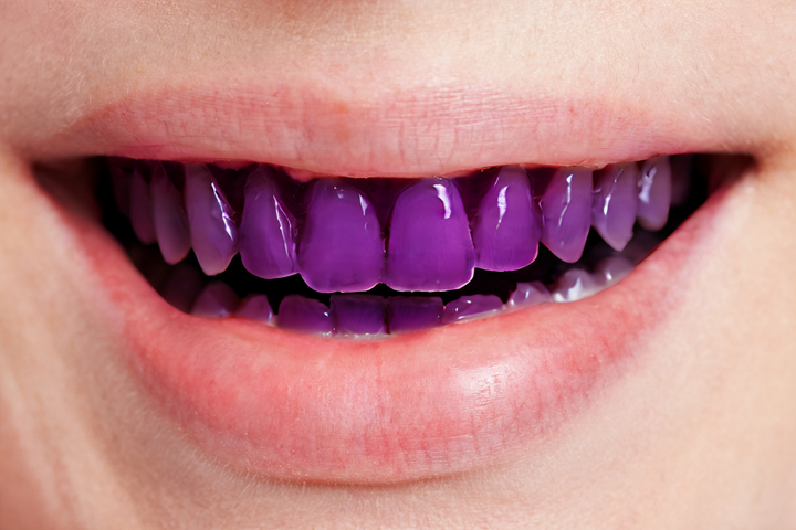 Teeth stained purple